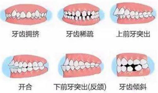 为什么孩子牙齿都有矫正(为什么孩子牙齿都有矫正的)(图1)